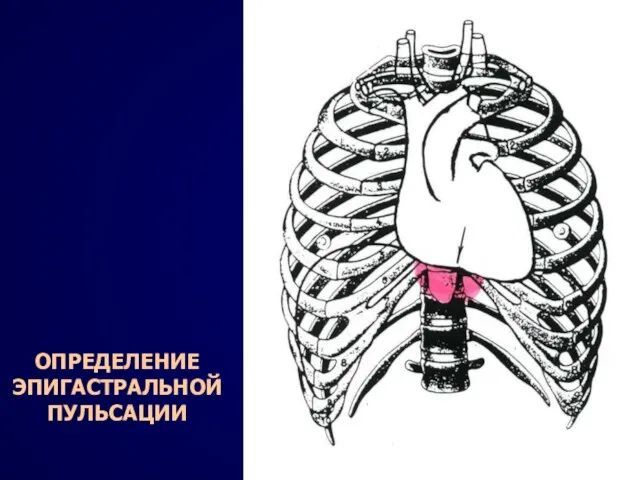 ОПРЕДЕЛЕНИЕ ЭПИГАСТРАЛЬНОЙ ПУЛЬСАЦИИ