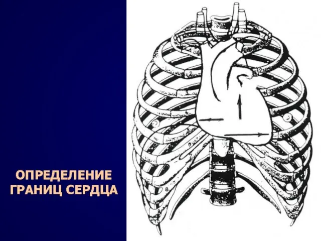 ОПРЕДЕЛЕНИЕ ГРАНИЦ СЕРДЦА