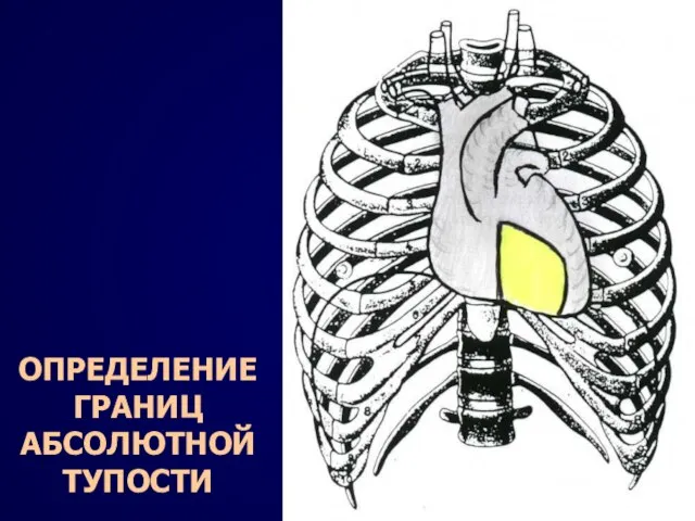 ОПРЕДЕЛЕНИЕ ГРАНИЦ АБСОЛЮТНОЙ ТУПОСТИ