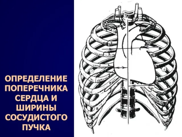 ОПРЕДЕЛЕНИЕ ПОПЕРЕЧНИКА СЕРДЦА И ШИРИНЫ СОСУДИСТОГО ПУЧКА