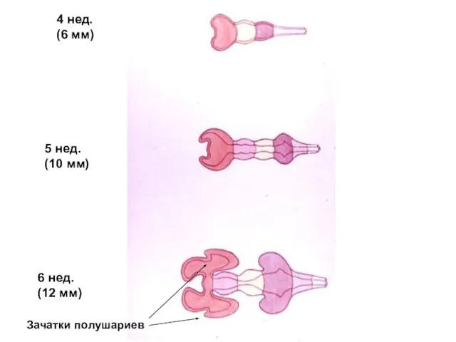 4 нед. (6 мм) 5 нед. (10 мм) 6 нед. (12 мм) Зачатки полушариев