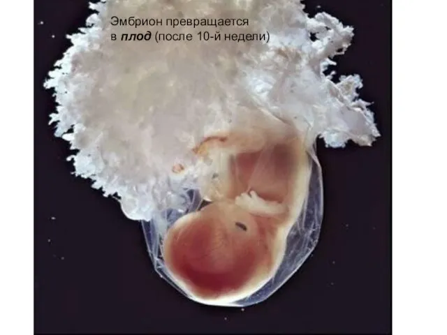 Эмбрион превращается в плод (после 10-й недели)