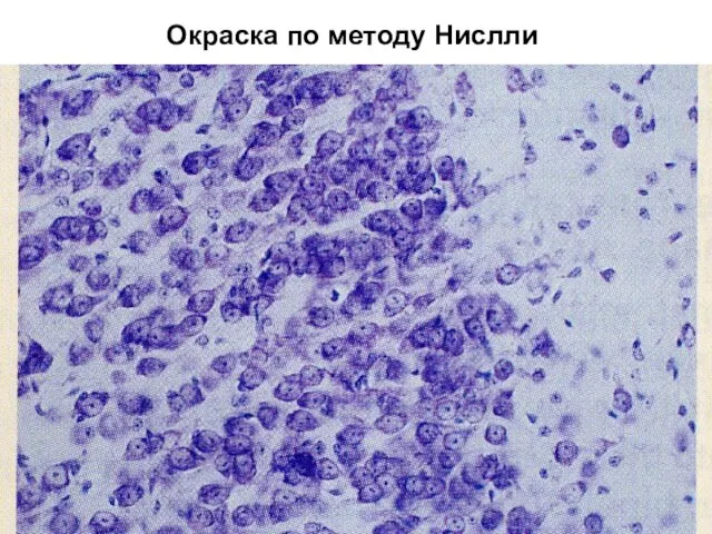 Окраска по методу Нислли