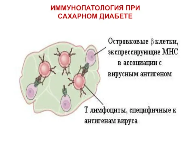 ИММУНОПАТОЛОГИЯ ПРИ САХАРНОМ ДИАБЕТЕ