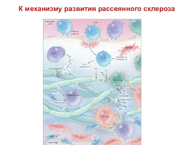 К механизму развития рассеянного склероза Figure 4. The Multiple Sclerosis Plaque. Within