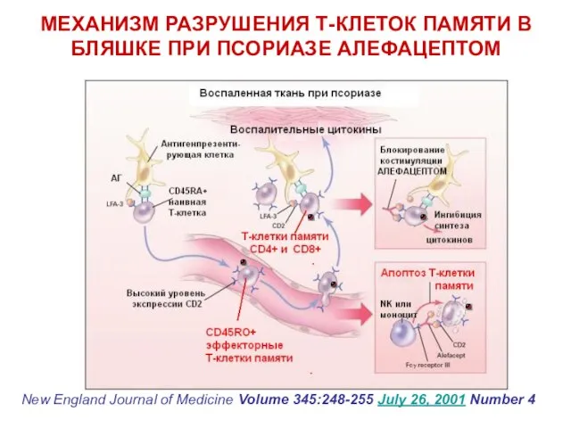 МЕХАНИЗМ РАЗРУШЕНИЯ Т-КЛЕТОК ПАМЯТИ В БЛЯШКЕ ПРИ ПСОРИАЗЕ АЛЕФАЦЕПТОМ New England Journal