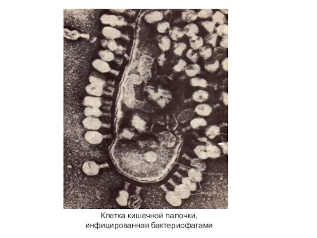 Клетка кишечной палочки, инфицированная бактериофагами