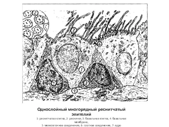 Однослойный многорядный реснитчатый эпителий 1- реснитчатая клетка, 2- реснички, 3- базальная клетка,