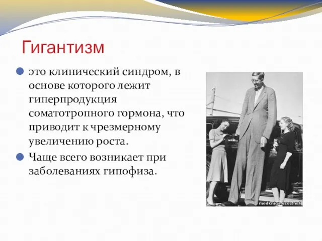 Гигантизм это клинический синдром, в основе которого лежит гиперпродукция соматотропного гормона, что