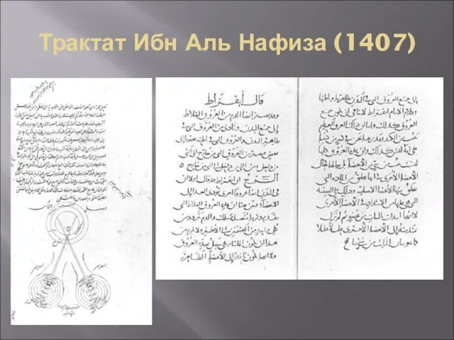 Трактат Ибн Аль Нафиза (1407)