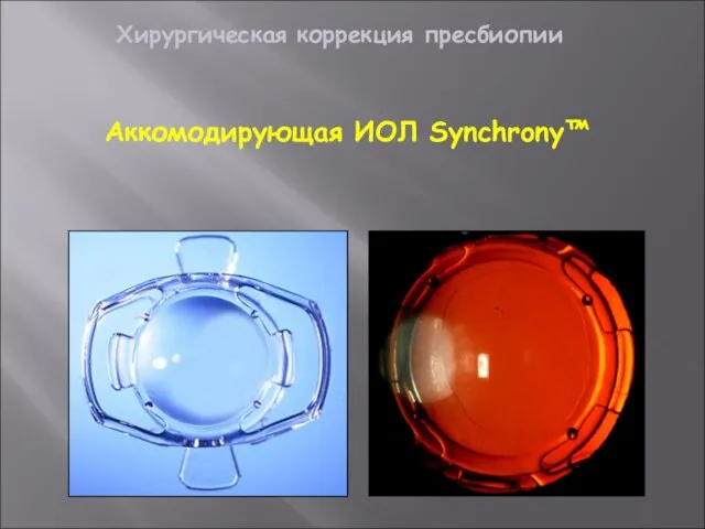 Аккомодирующая ИОЛ Synchrony™ Хирургическая коррекция пресбиопии