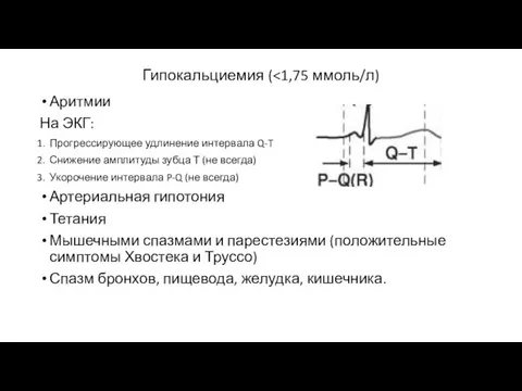 Гипокальциемия ( Аритмии На ЭКГ: Прогрессирующее удлинение интервала Q-T Снижение амплитуды зубца