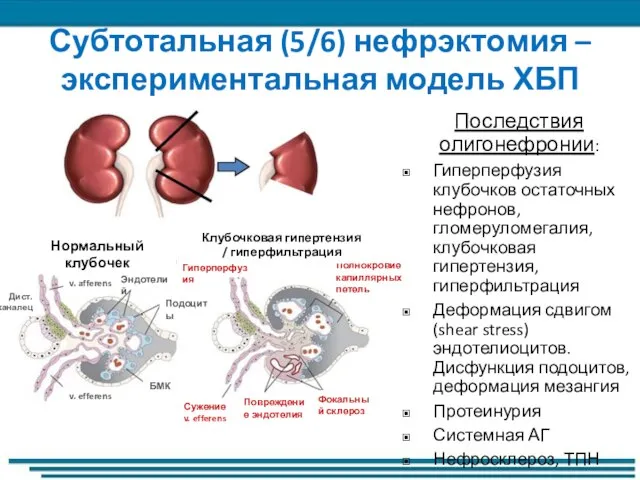 Субтотальная (5/6) нефрэктомия – экспериментальная модель ХБП Нормальный клубочек БМК Подоциты v.