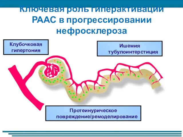 Ключевая роль гиперактивации РААС в прогрессировании нефросклероза Ишемия тубулоинтерстиция Клубочковая гипертония Протеинурическое повреждение/ремоделирование