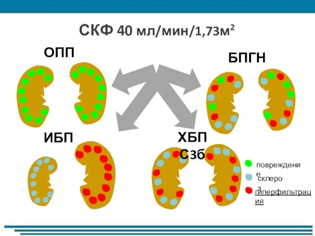 повреждение склероз гиперфильтрация ОПП ИБП БПГН ХБП С3б СКФ 40 мл/мин/1,73м2