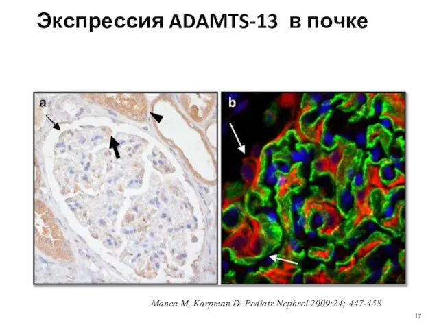 Экспрессия ADAMTS-13 в почке Manea M, Karpman D. Pediatr Nephrol 2009:24; 447-458