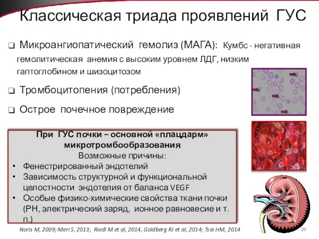 Классическая триада проявлений ГУС Микроангиопатический гемолиз (МАГА): Кумбс - негативная гемолитическая анемия