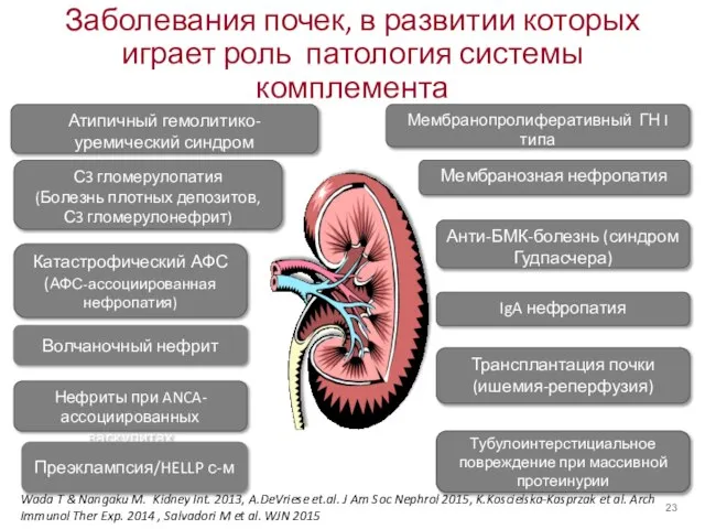 Заболевания почек, в развитии которых играет роль патология системы комплемента Мембранозная нефропатия