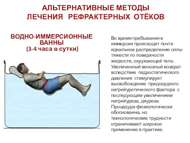 АЛЬТЕРНАТИВНЫЕ МЕТОДЫ ЛЕЧЕНИЯ РЕФРАКТЕРНЫХ ОТЁКОВ ВОДНО-ИММЕРСИОННЫЕ ВАННЫ (3-4 часа в сутки) Во