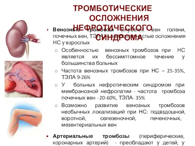 Венозные тромбозы (глубоких вен голени, почечных вен, ТЭЛА) – наиболее частые осложнения