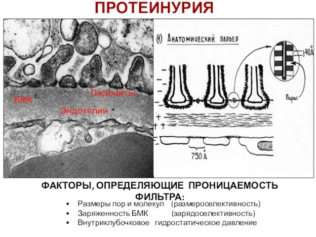 ПРОТЕИНУРИЯ Размеры пор и молекул (размероселективность) Заряженность БМК (зарядоселективность) Внутриклубочковое гидростатическое давление ФАКТОРЫ, ОПРЕДЕЛЯЮЩИЕ ПРОНИЦАЕМОСТЬ ФИЛЬТРА: