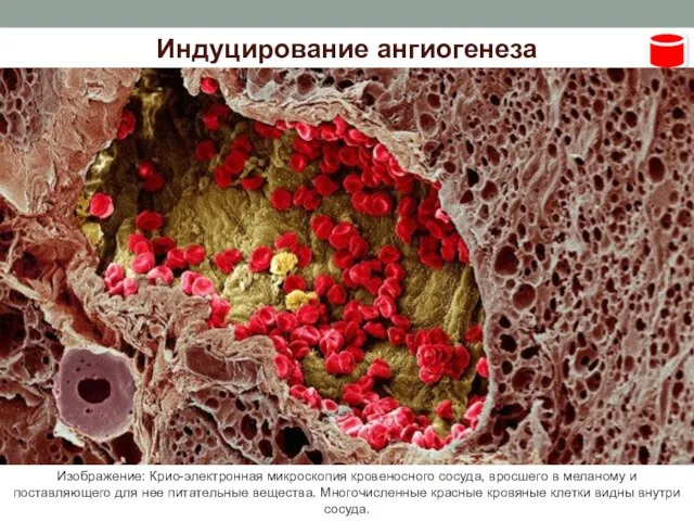 Индуцирование ангиогенеза Изображение: Крио-электронная микроскопия кровеносного сосуда, вросшего в меланому и поставляющего