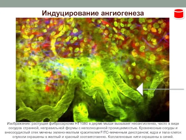 Индуцирование ангиогенеза Изображение: растущая фибросаркома HT1080 в дерме мыши вызывает неоангиогенез, часто