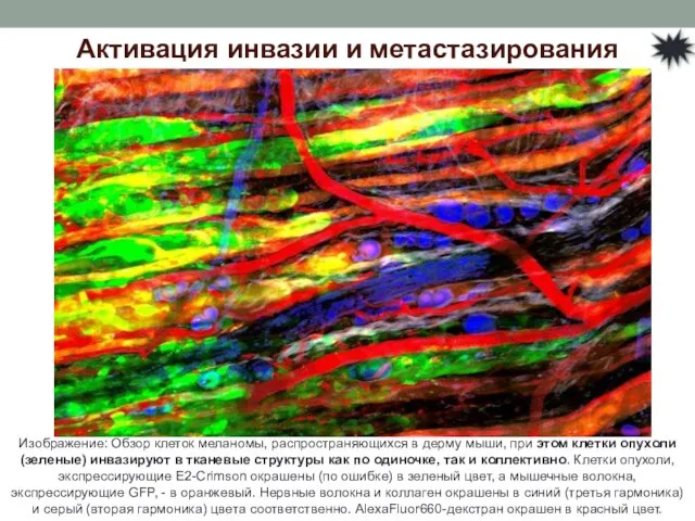 Активация инвазии и метастазирования Изображение: Обзор клеток меланомы, распространяющихся в дерму мыши,