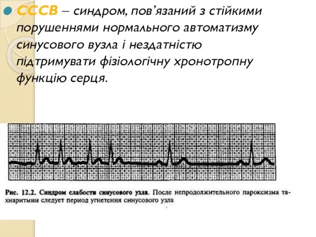 СССВ – синдром, пов’язаний з стійкими порушеннями нормального автоматизму синусового вузла і