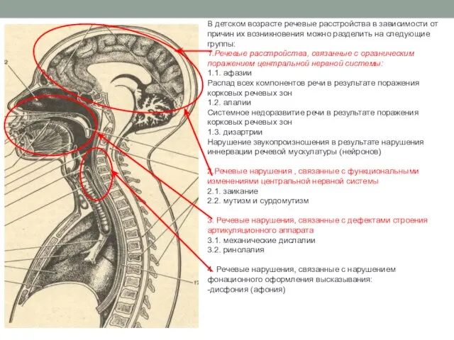 В детском возрасте речевые расстройства в зависимости от причин их возникновения можно