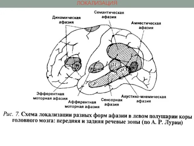 ЛОКАЛИЗАЦИЯ