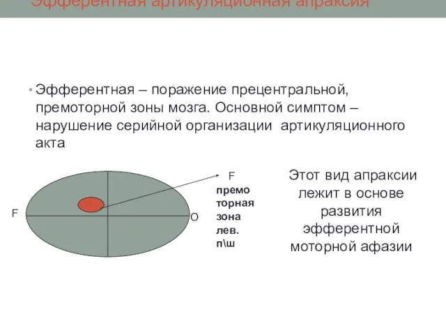 Эфферентная артикуляционная апраксия Эфферентная – поражение прецентральной, премоторной зоны мозга. Основной симптом