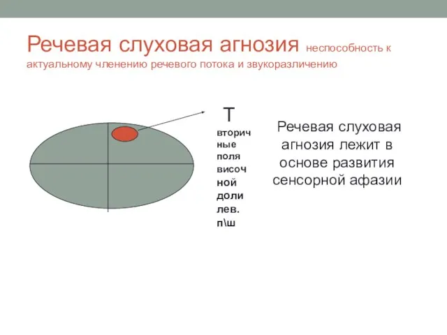 Речевая слуховая агнозия неспособность к актуальному членению речевого потока и звукоразличению T