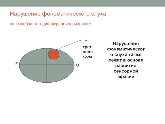 Нарушение фонематического слуха неспособность к дифференциации фонем F O T трет. полякоры