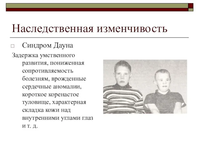 Наследственная изменчивость Синдром Дауна Задержка умственного развития, пониженная сопротивляемость болезням, врожденные сердечные