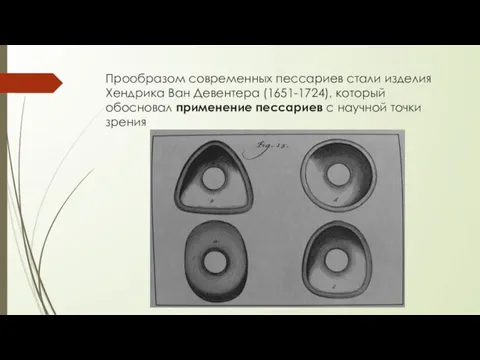 Прообразом современных пессариев стали изделия Хендрика Ван Девентера (1651-1724), который обосновал применение