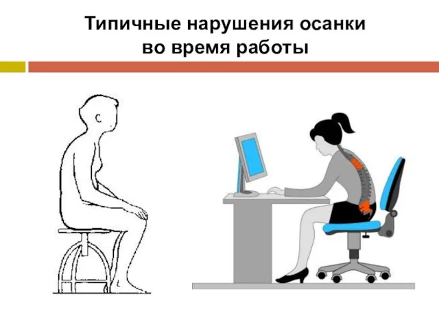 Типичные нарушения осанки во время работы