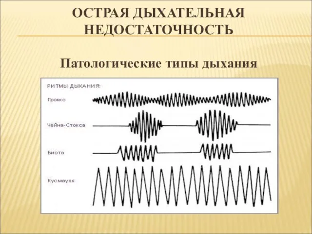 ОСТРАЯ ДЫХАТЕЛЬНАЯ НЕДОСТАТОЧНОСТЬ Патологические типы дыхания