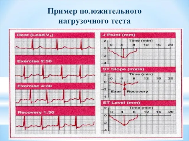 Пример положительного нагрузочного теста V1 V2 V3 V4