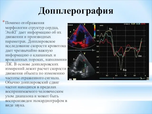 Допплерография Помимо отображения морфологии структур сердца, ЭхоКГ дает информацию об их движении