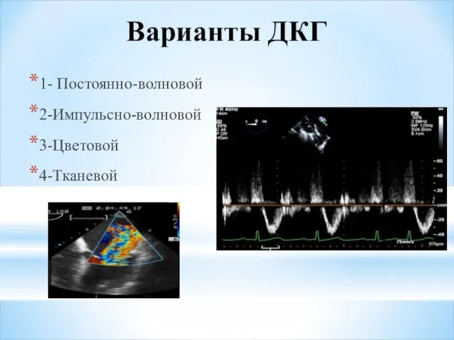 Варианты ДКГ 1- Постоянно-волновой 2-Импульсно-волновой 3-Цветовой 4-Тканевой