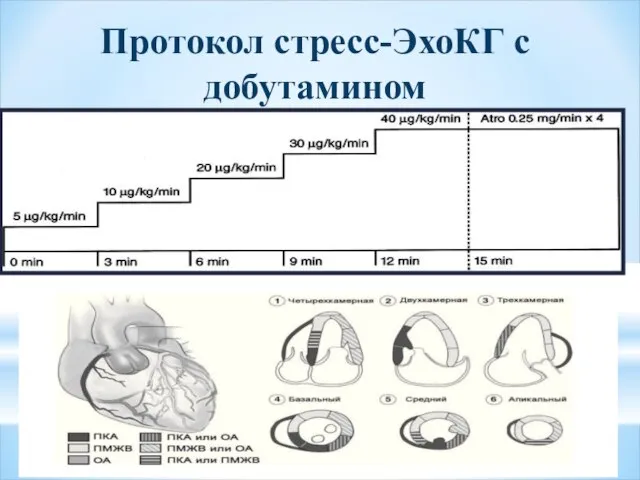 Протокол стресс-ЭхоКГ с добутамином