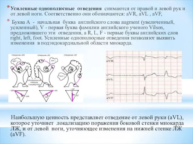 Усиленные однополюсные отведения снимаются от правой и левой рук и от левой