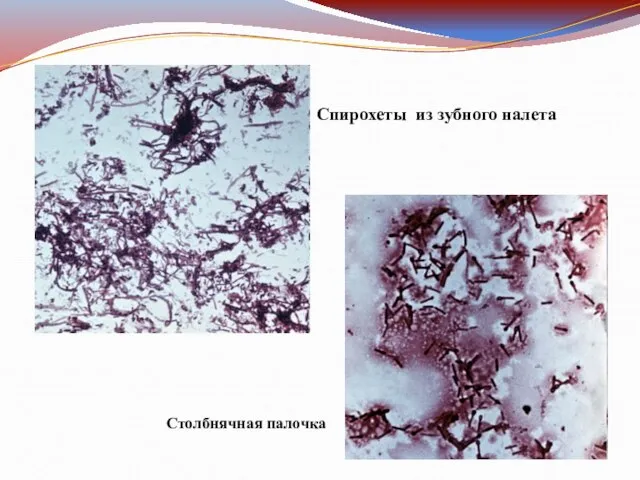 Спирохеты из зубного налета Столбнячная палочка