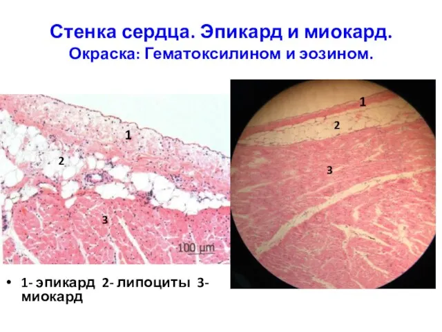 Стенка сердца. Эпикард и миокард. Окраска: Гематоксилином и эозином. 1- эпикард 2-