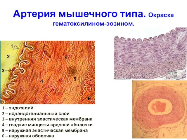 Артерия мышечного типа. Окраска гематоксилином-эозином. 1 – эндотелий 2 – подэндотелиальный слой