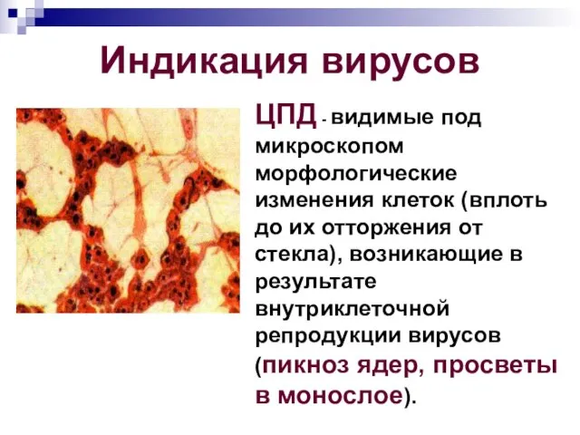 Индикация вирусов ЦПД - видимые под микроскопом морфологические изменения клеток (вплоть до