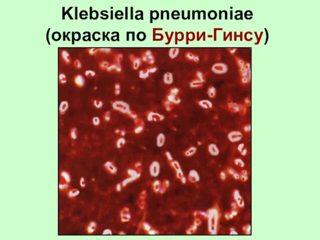 Klebsiella pneumoniae (окраска по Бурри-Гинсу)