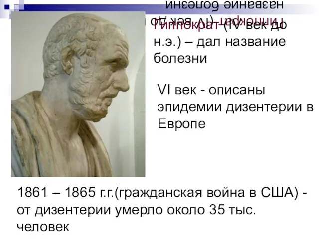 Гиппократ (IV век до н.э.) – дал название болезни Гиппократ (IV век