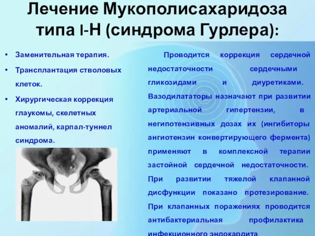 Лечение Мукополисахаридоза типа I-Н (синдрома Гурлера): Заменительная терапия. Трансплантация стволовых клеток. Хирургическая